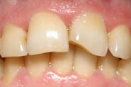 rec angle